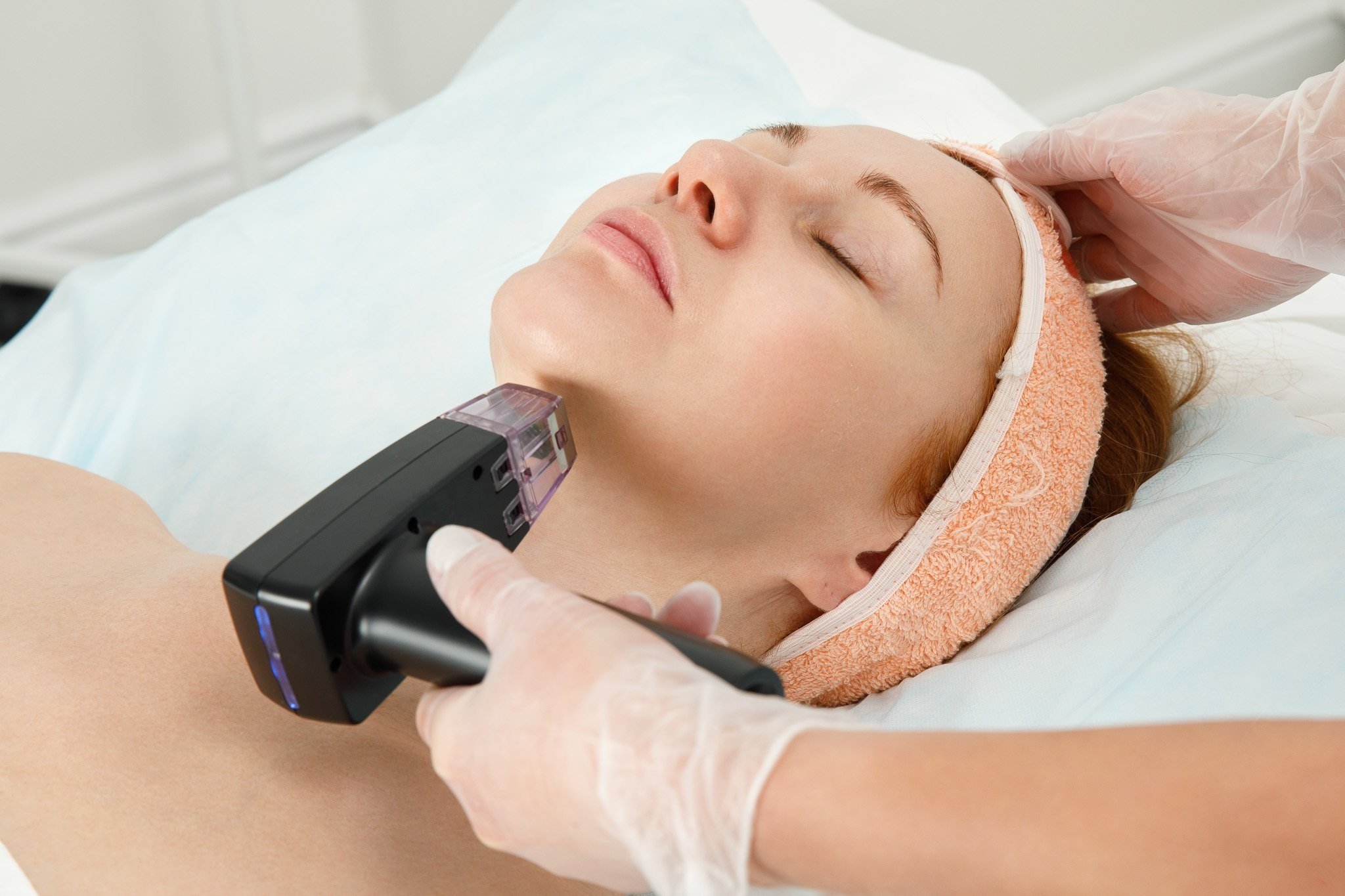 Morpheus8 Treatment in Myrtle Beach - All You Need To Know - La